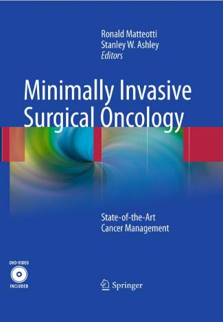 minimally-invasive-surgical-oncology-state-of-the-art-cancer-management.jpg