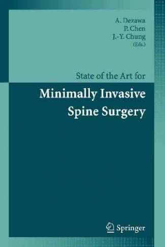 state-of-the-art-for-minimally-invasive-spine-surgery.jpg